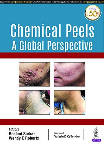 Chemical Peels: A Global Perspective