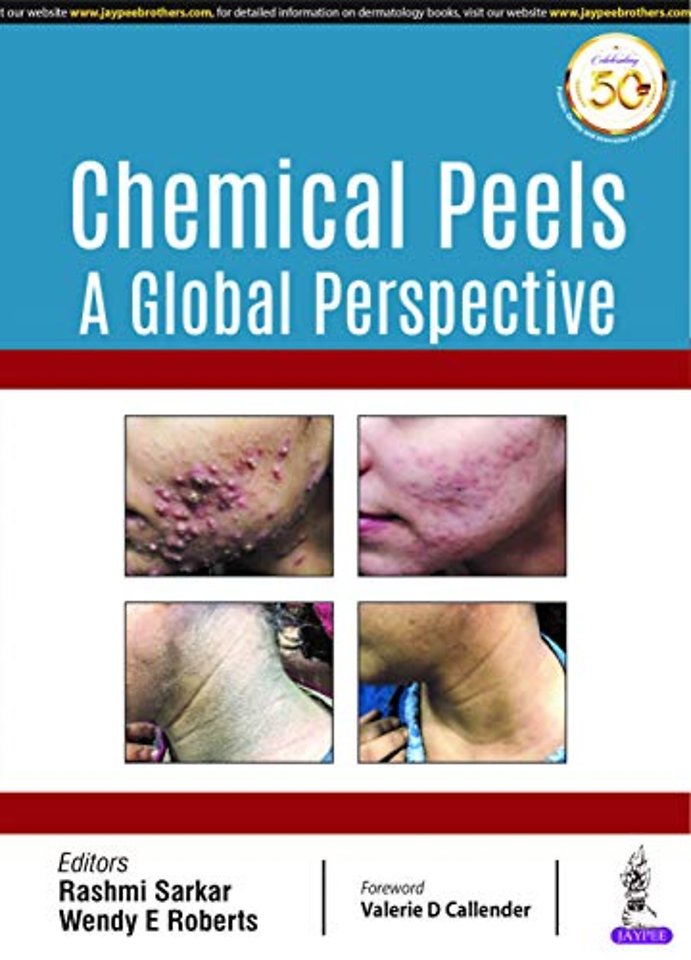 Chemical Peels: A Global Perspective