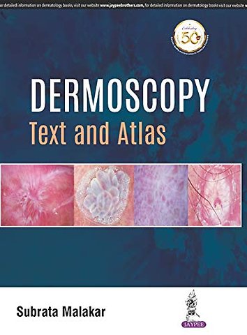 Dermoscopy