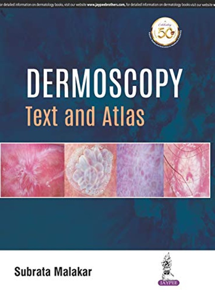 Dermoscopy