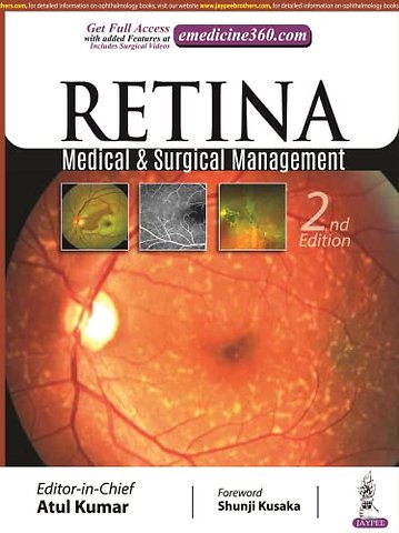 Retina