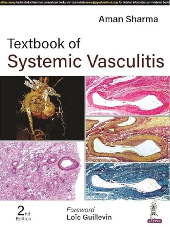 Textbook of Systemic Vasculitis