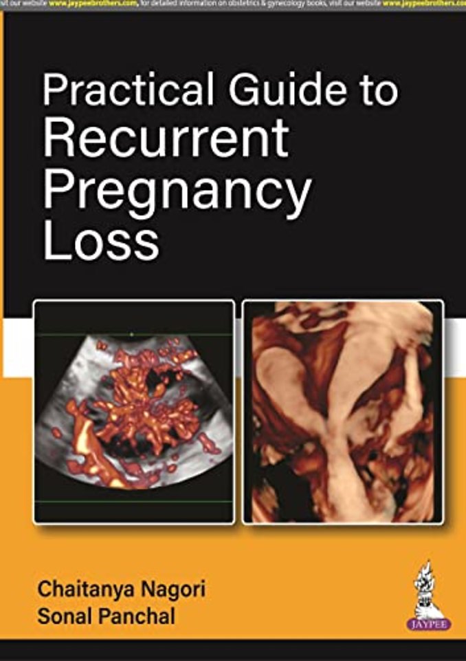 Practical Guide to Recurrent Pregnancy Loss