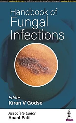 Handbook of Fungal Infections