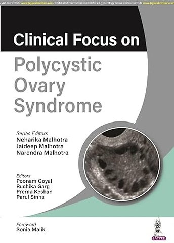 Clinical Focus on Polycystic Ovary Syndrome