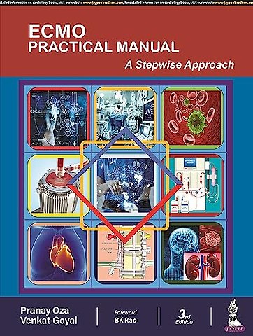 ECMO Practical Manual