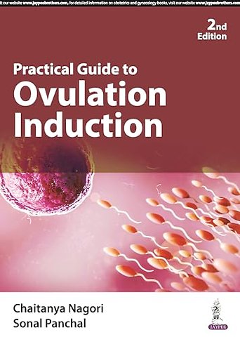 Practical Guide to Ovulation Induction