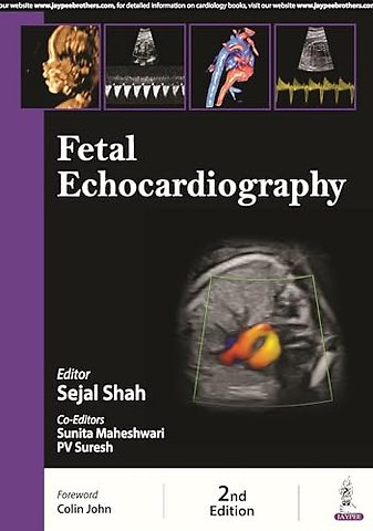 Fetal Echocardiography