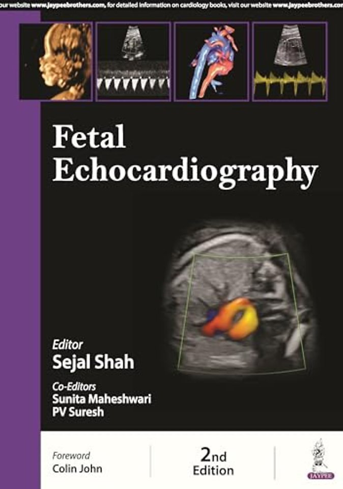 Fetal Echocardiography