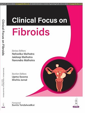 Clinical Focus on Fibroids