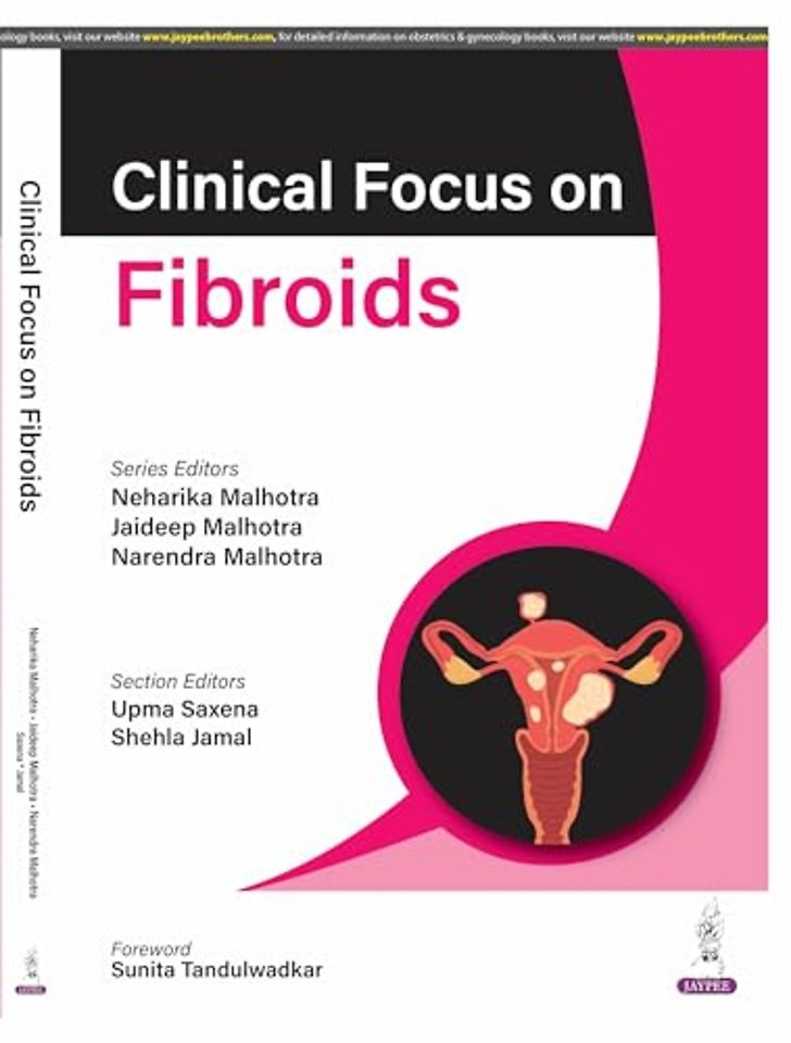 Clinical Focus on Fibroids