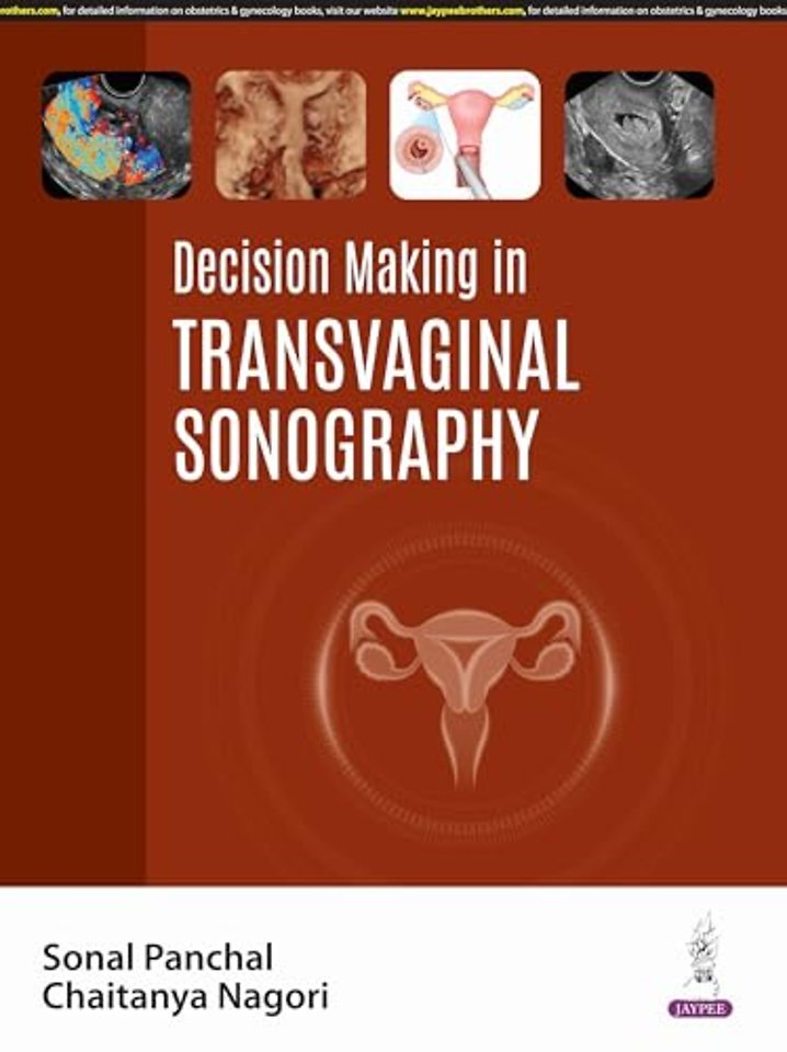 Decision Making in Transvaginal Sonography