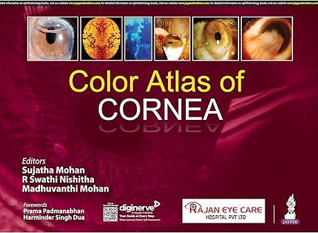 Color Atlas of Cornea