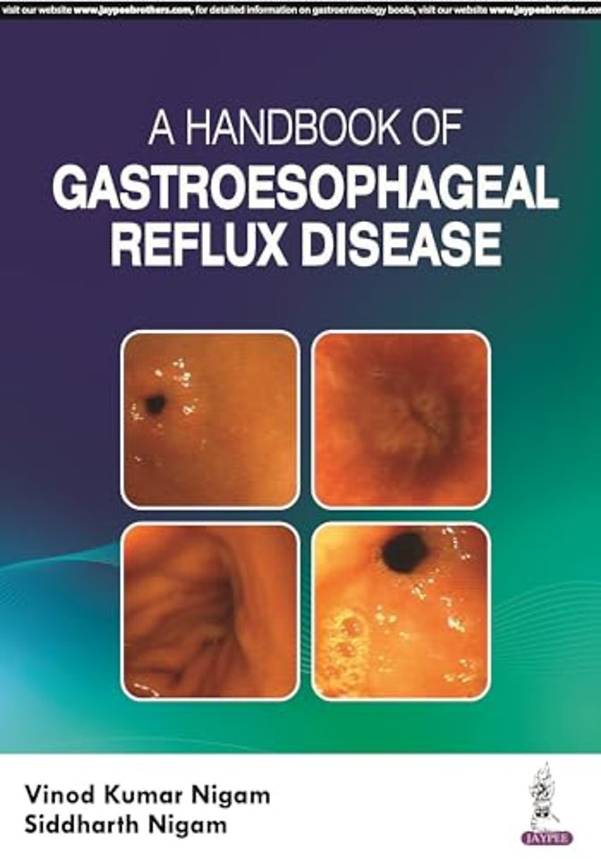 A Handbook of Gastroesophageal Reflux Disease (GERD)