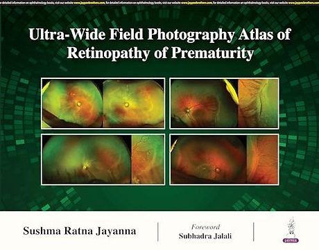 Ultra-Wide Field Photography Atlas of Retinopathy of Prematurity