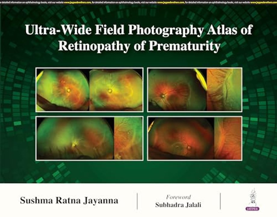 Ultra-Wide Field Photography Atlas of Retinopathy of Prematurity