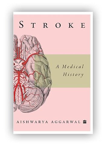 Stroke