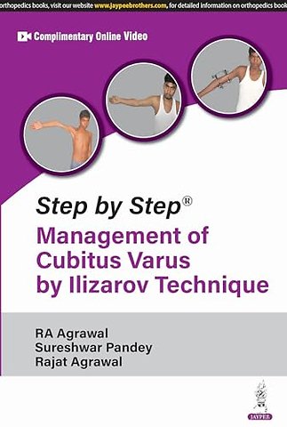 Step by Step: Management of Cubitus Varus by Ilizarov Technique