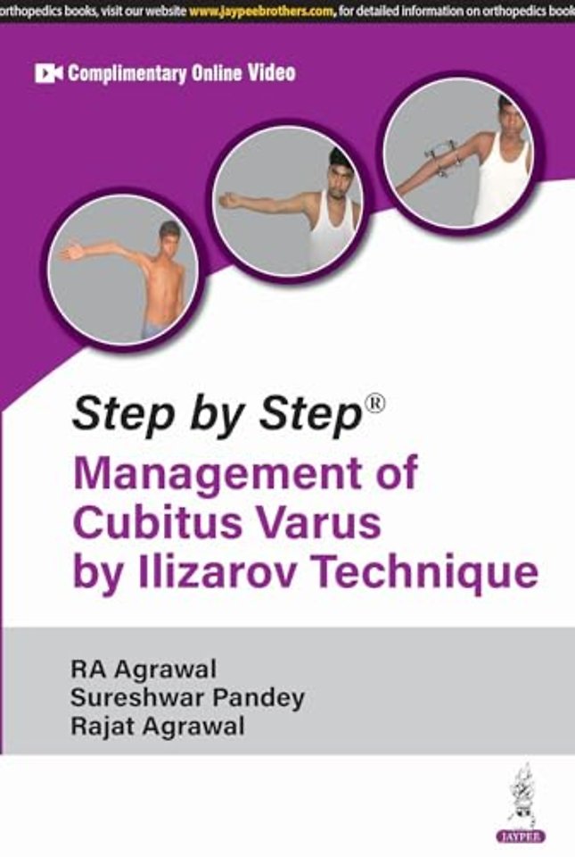 Step by Step: Management of Cubitus Varus by Ilizarov Technique