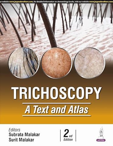 Trichoscopy