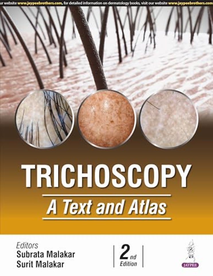 Trichoscopy