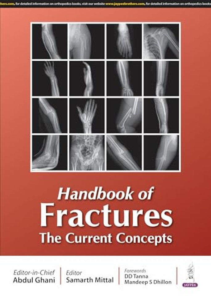 Handbook of Fractures
