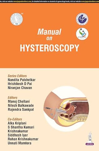 Manual on Hysteroscopy