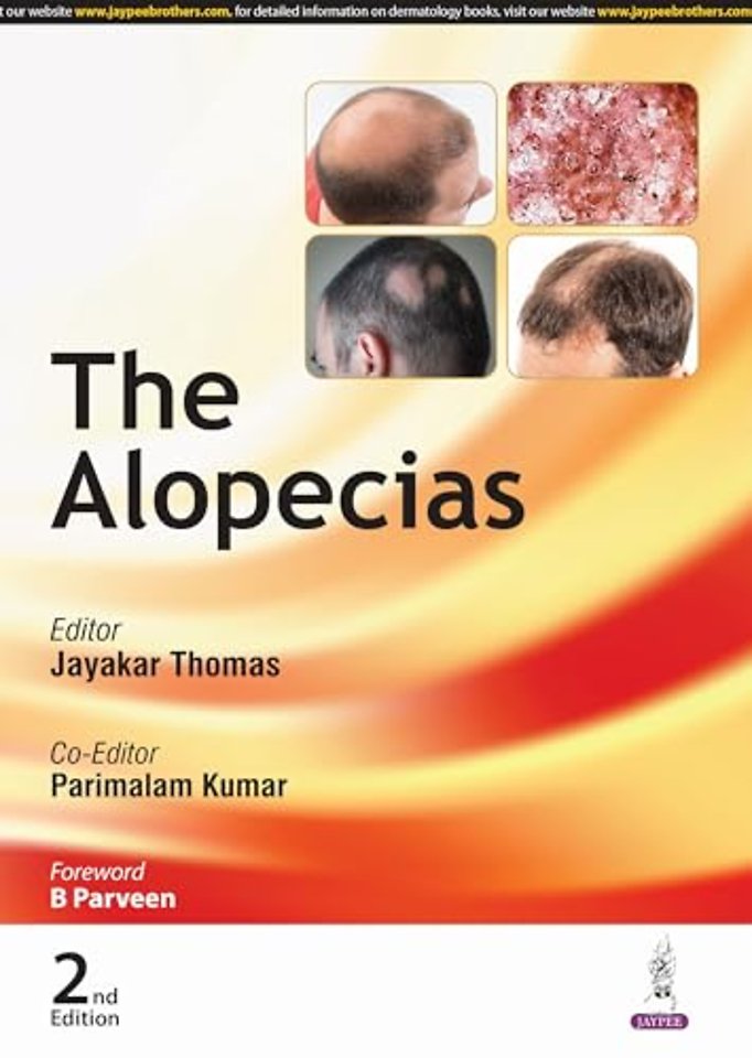 The Alopecias