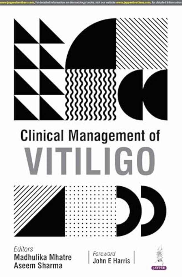 Clinical Management of Vitiligo