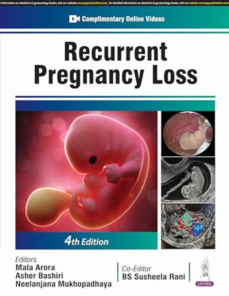 Recurrent Pregnancy Loss