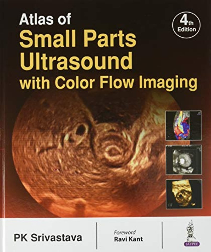 Atlas of Small Parts Ultrasound