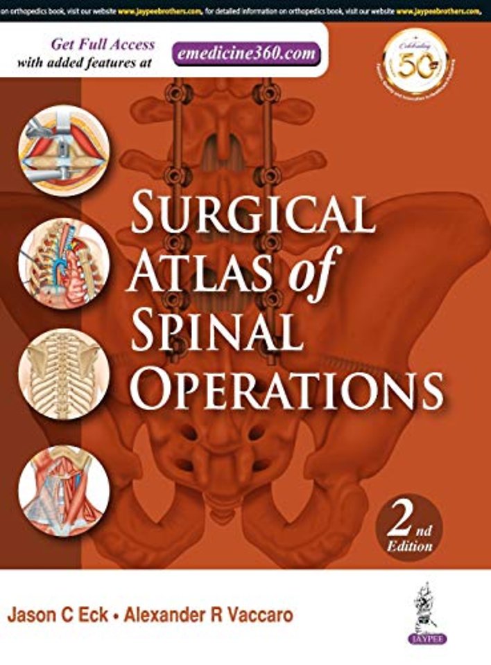 Surgical Atlas of Spinal Operations