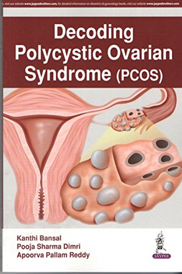 Decoding Polycystic Ovarian Syndrome