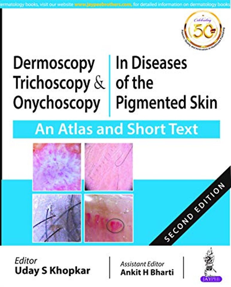 Dermoscopy, Trichoscopy and Onychoscopy in Diseases of the Pigmented Skin