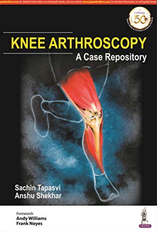Knee Arthroscopy