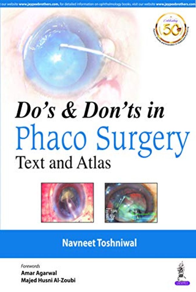 Do's & Dont's in Phaco Surgery