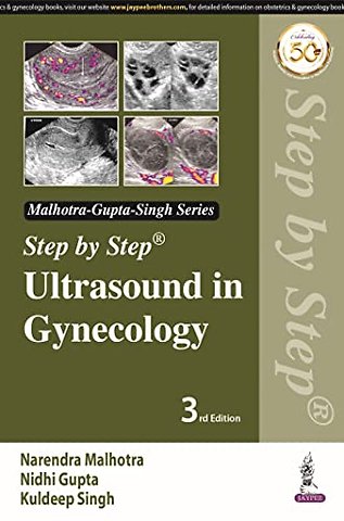 Step by Step Ultrasound in Gynecology