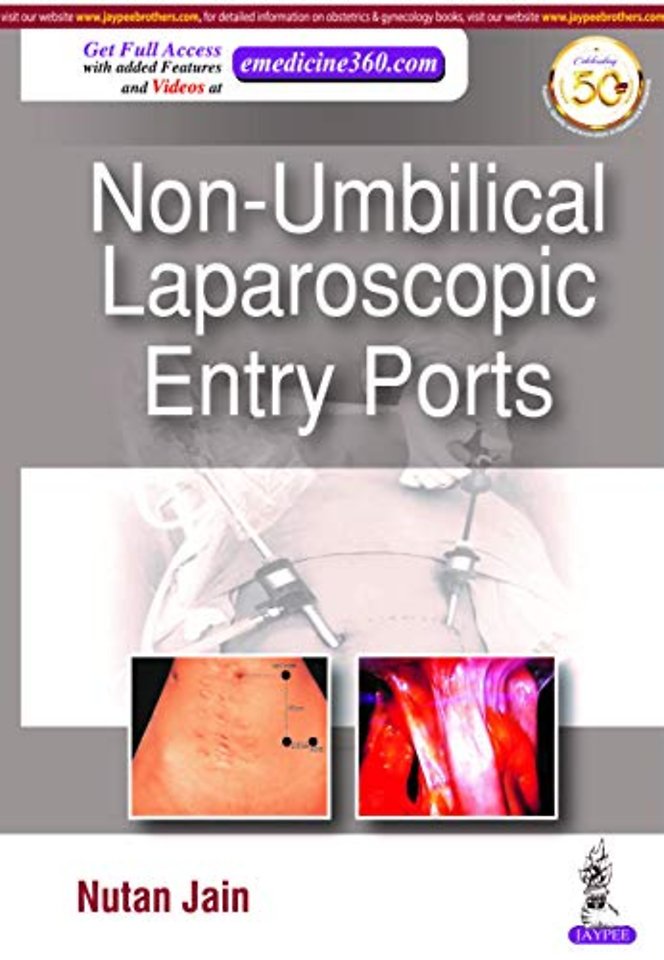 Non-Umbilical Laparoscopic Entry Ports