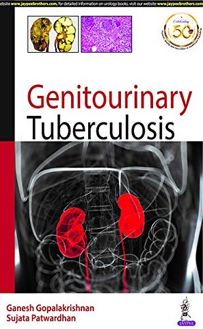 Genitourinary Tuberculosis