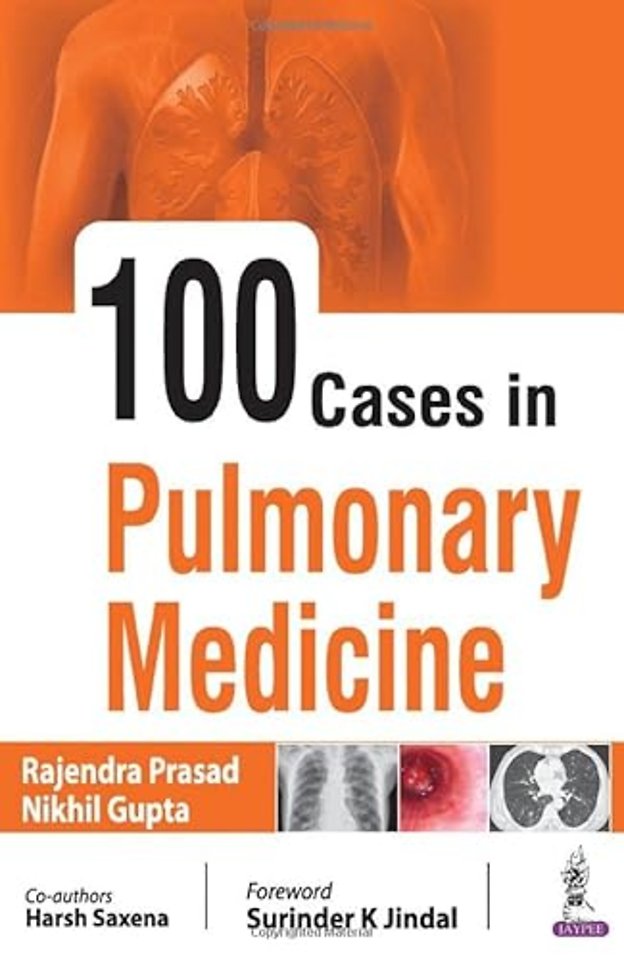 100 Cases in Pulmonary Medicine