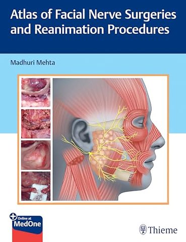 Atlas of Facial Nerve Surgeries and Reanimation Procedures