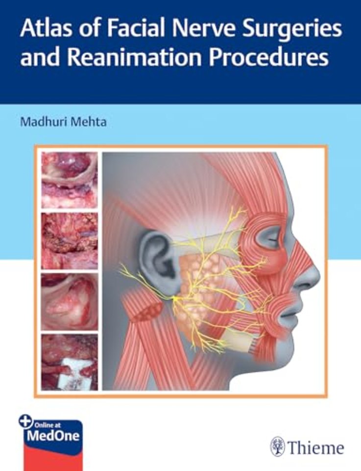 Atlas of Facial Nerve Surgeries and Reanimation Procedures