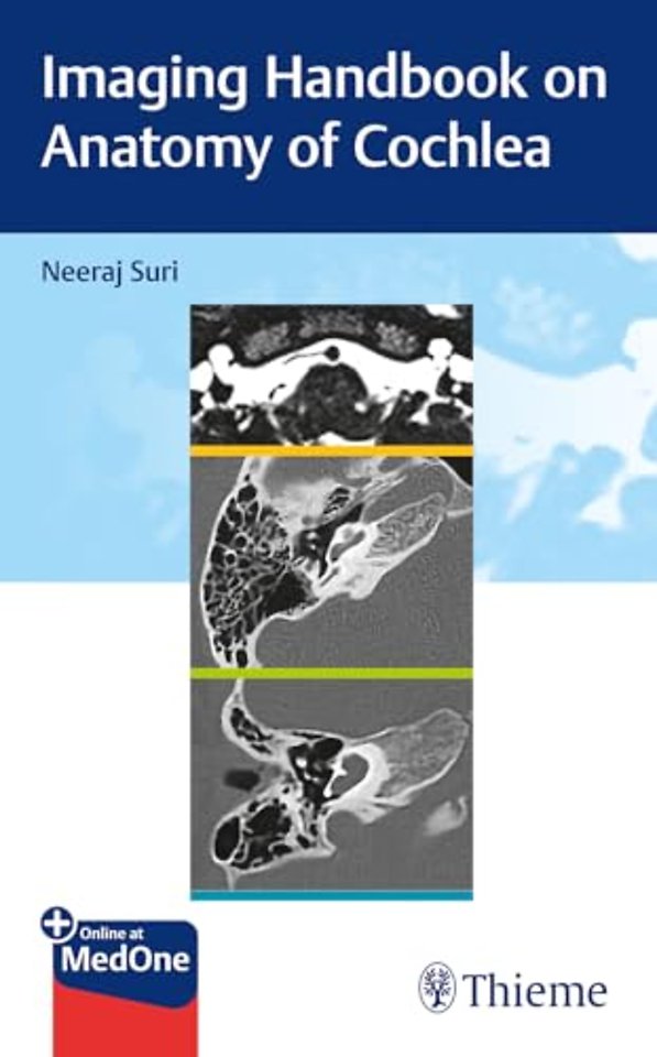 Imaging Handbook on Anatomy of Cochlea