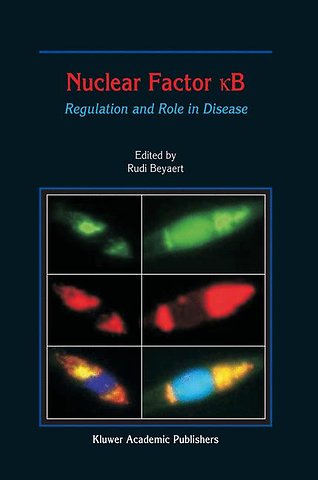 Nuclear Factor кB