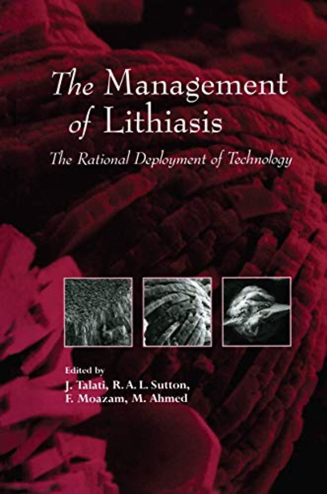 The Management of Lithiasis