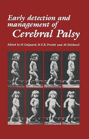 Early Detection and Management of Cerebral Palsy