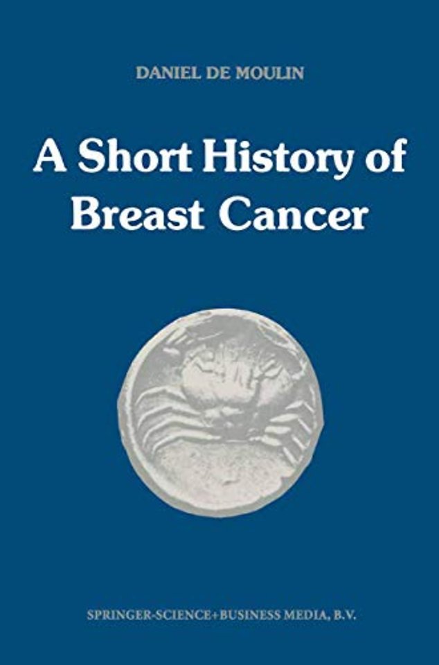 A short history of breast cancer