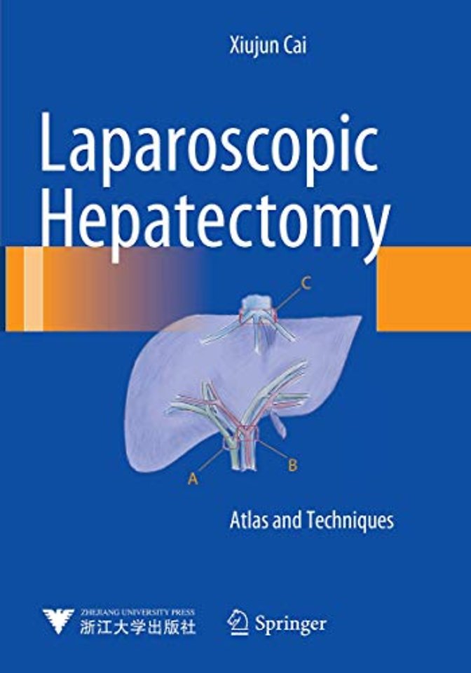 Laparoscopic Hepatectomy