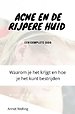 Acne bij volwassenen