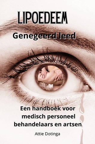 Lipoedeem
